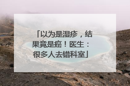 以为是湿疹，结果竟是癌！医生：很多人去错科室